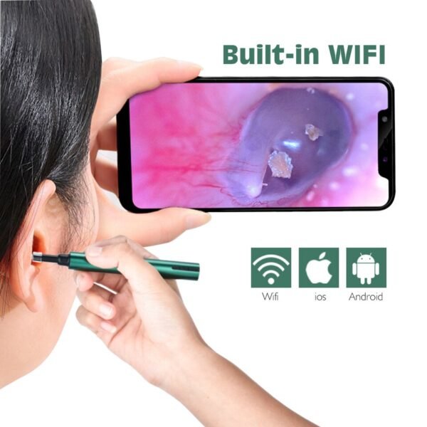 3.9mm WiFi Wireless Tool Ear Cleaner Wax LED Light Camera Otoscope for Android IOS - Image 10